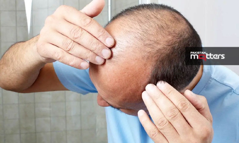 Hairfall ii