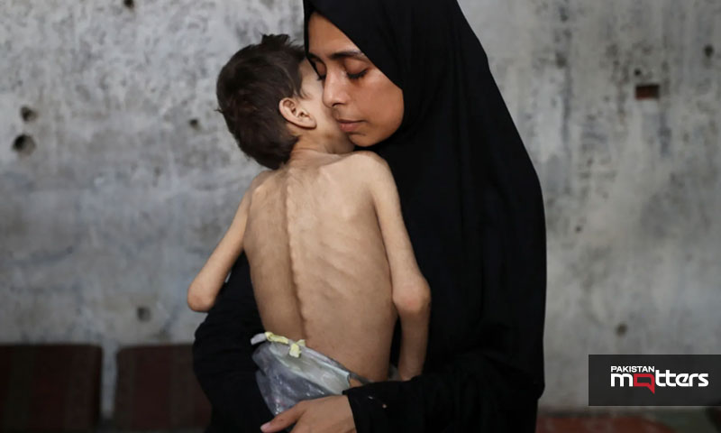 Israel’s starvation