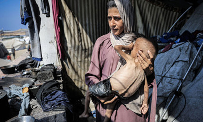 Live israel’s starvation