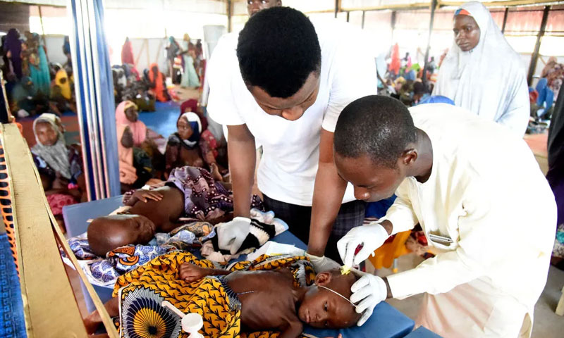 Malnutrition ii